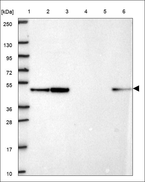 Lane 1: Marker [kDa] 250,130,95,72,55,36,28,17,10 Lane 2: RT4 Lane 3: U-251 MG Lane 4: Human Plasma Lane 5: Liver Lane 6: Tonsil