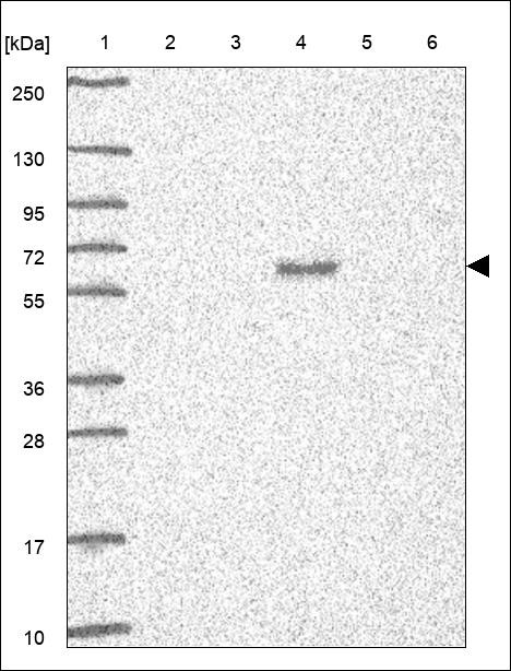 Lane 1: Marker [kDa] 250,130,95,72,55,36,28,17,10 Lane 2: RT4 Lane 3: U-251 MG Lane 4: Human Plasma Lane 5: Liver Lane 6: Tonsil