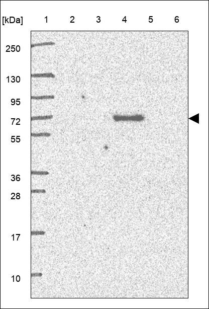Lane 1: Marker [kDa] 250,130,95,72,55,36,28,17,10 Lane 2: RT4 Lane 3: U-251 MG Lane 4: Human Plasma Lane 5: Liver Lane 6: Tonsil