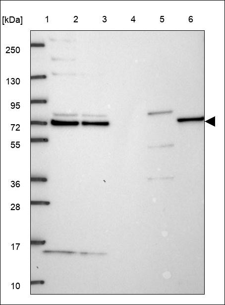 Lane 1: Marker [kDa] 250,130,95,72,55,36,28,17,10 Lane 2: RT4 Lane 3: U-251 MG Lane 4: Human Plasma Lane 5: Liver Lane 6: Tonsil