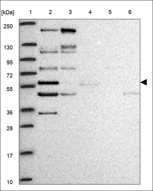 Lane 1: Marker [kDa] 250,130,95,72,55,36,28,17,10 Lane 2: RT4 Lane 3: U-251 MG Lane 4: Human Plasma Lane 5: Liver Lane 6: Tonsil