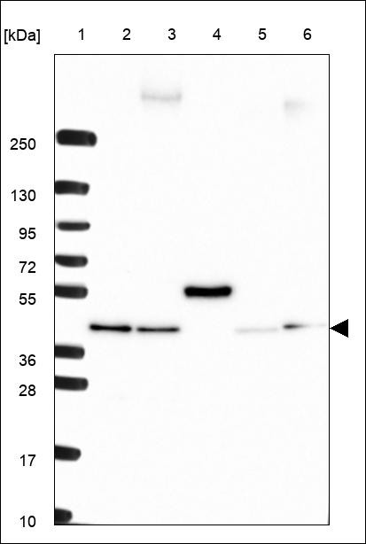Lane 1: Marker [kDa] 250,130,95,72,55,36,28,17,10 Lane 2: RT4 Lane 3: U-251 MG Lane 4: Human Plasma Lane 5: Liver Lane 6: Tonsil