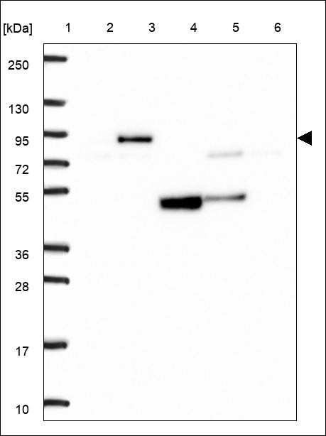 Lane 1: Marker [kDa] 250,130,95,72,55,36,28,17,10 Lane 2: RT4 Lane 3: U-251 MG Lane 4: Human Plasma Lane 5: Liver Lane 6: Tonsil