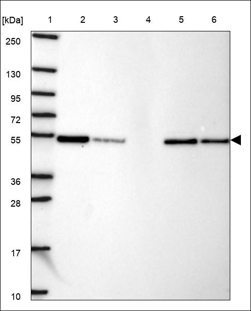 Lane 1: Marker [kDa] 250,130,95,72,55,36,28,17,10 Lane 2: RT4 Lane 3: U-251 MG Lane 4: Human Plasma Lane 5: Liver Lane 6: Tonsil