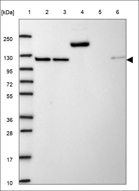 Lane 1: Marker [kDa] 250,130,95,72,55,36,28,17,10 Lane 2: RT4 Lane 3: U-251 MG Lane 4: Human Plasma Lane 5: Liver Lane 6: Tonsil