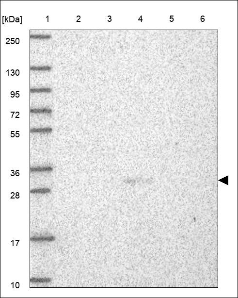 Lane 1: Marker [kDa] 250,130,95,72,55,36,28,17,10 Lane 2: RT4 Lane 3: U-251 MG Lane 4: Human Plasma Lane 5: Liver Lane 6: Tonsil