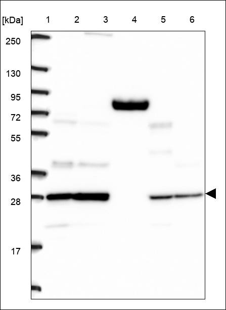 Lane 1: Marker [kDa] 250,130,95,72,55,36,28,17,10 Lane 2: RT4 Lane 3: U-251 MG Lane 4: Human Plasma Lane 5: Liver Lane 6: Tonsil