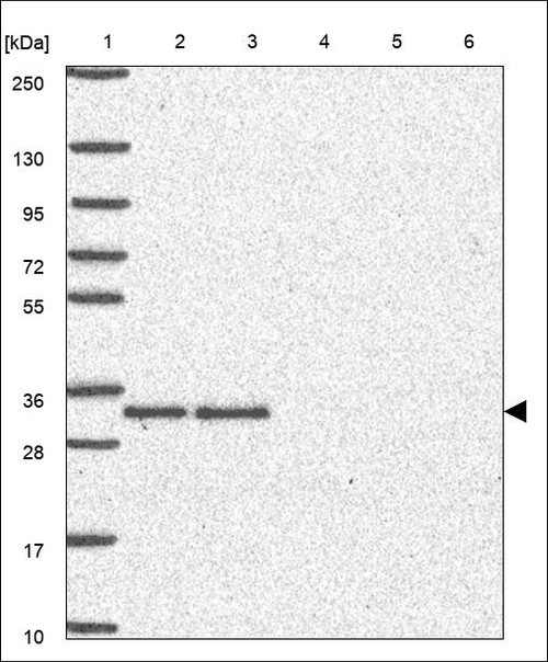 Lane 1: Marker [kDa] 250,130,95,72,55,36,28,17,10 Lane 2: RT4 Lane 3: U-251 MG Lane 4: Human Plasma Lane 5: Liver Lane 6: Tonsil