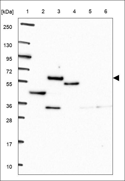 Lane 1: Marker [kDa] 250,130,95,72,55,36,28,17,10 Lane 2: RT4 Lane 3: U-251 MG Lane 4: Human Plasma Lane 5: Liver Lane 6: Tonsil