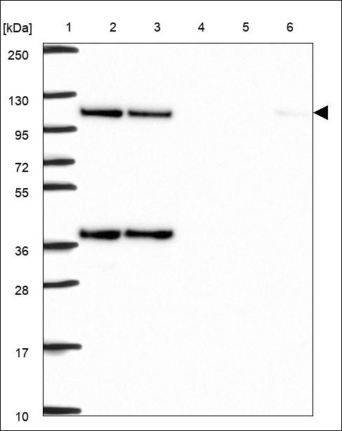 Lane 1: Marker [kDa] 250,130,95,72,55,36,28,17,10 Lane 2: RT4 Lane 3: U-251 MG Lane 4: Human Plasma Lane 5: Liver Lane 6: Tonsil