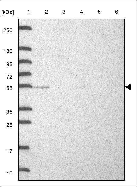 Lane 1: Marker [kDa] 250,130,95,72,55,36,28,17,10 Lane 2: RT4 Lane 3: U-251 MG Lane 4: Human Plasma Lane 5: Liver Lane 6: Tonsil