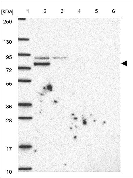 Lane 1: Marker [kDa] 250,130,95,72,55,36,28,17,10 Lane 2: RT4 Lane 3: U-251 MG Lane 4: Human Plasma Lane 5: Liver Lane 6: Tonsil