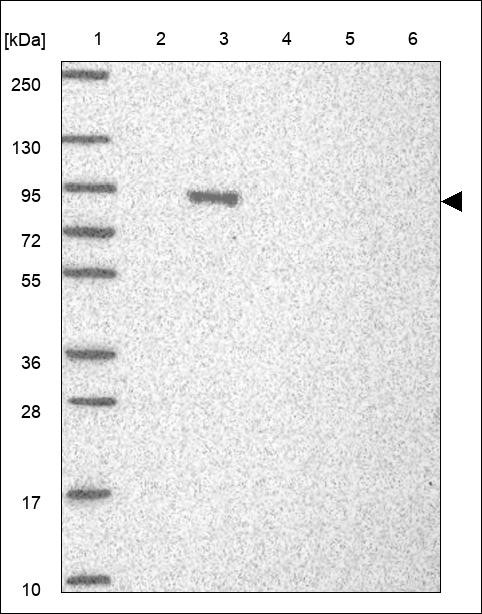 Lane 1: Marker [kDa] 250,130,95,72,55,36,28,17,10 Lane 2: RT4 Lane 3: U-251 MG Lane 4: Human Plasma Lane 5: Liver Lane 6: Tonsil