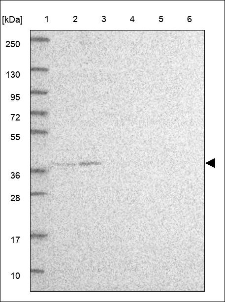 Lane 1: Marker [kDa] 250,130,95,72,55,36,28,17,10 Lane 2: RT4 Lane 3: U-251 MG Lane 4: Human Plasma Lane 5: Liver Lane 6: Tonsil