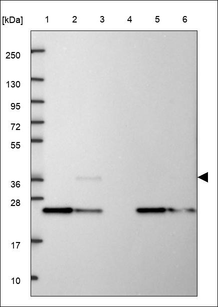 Lane 1: Marker [kDa] 250,130,95,72,55,36,28,17,10 Lane 2: RT4 Lane 3: U-251 MG Lane 4: Human Plasma Lane 5: Liver Lane 6: Tonsil