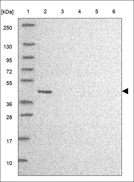 Lane 1: Marker [kDa] 250,130,95,72,55,36,28,17,10 Lane 2: RT4 Lane 3: U-251 MG Lane 4: Human Plasma Lane 5: Liver Lane 6: Tonsil