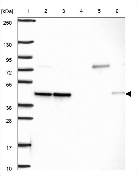 Lane 1: Marker [kDa] 250,130,95,72,55,36,28,17,10 Lane 2: RT4 Lane 3: U-251 MG Lane 4: Human Plasma Lane 5: Liver Lane 6: Tonsil