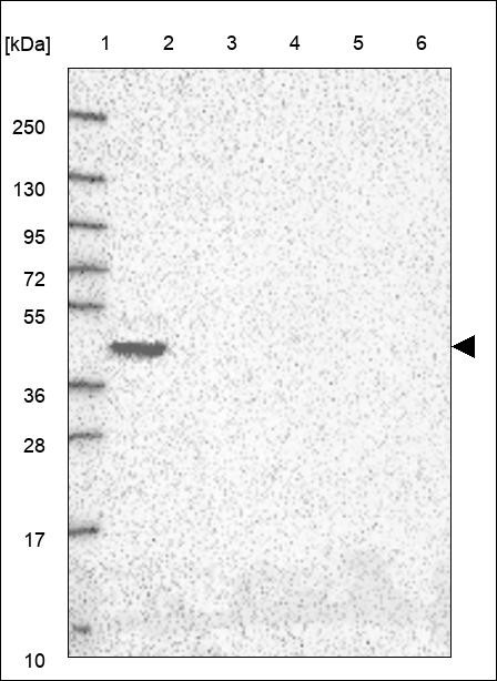 Lane 1: Marker [kDa] 250,130,95,72,55,36,28,17,10 Lane 2: RT4 Lane 3: U-251 MG Lane 4: Human Plasma Lane 5: Liver Lane 6: Tonsil