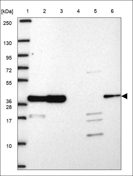 Lane 1: Marker [kDa] 250,130,95,72,55,36,28,17,10 Lane 2: RT4 Lane 3: U-251 MG Lane 4: Human Plasma Lane 5: Liver Lane 6: Tonsil