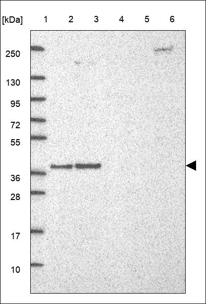 Lane 1: Marker [kDa] 250,130,95,72,55,36,28,17,10 Lane 2: RT4 Lane 3: U-251 MG Lane 4: Human Plasma Lane 5: Liver Lane 6: Tonsil