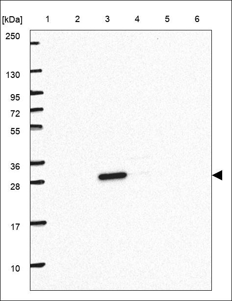 Lane 1: Marker [kDa] 250,130,95,72,55,36,28,17,10 Lane 2: RT4 Lane 3: U-251 MG Lane 4: Human Plasma Lane 5: Liver Lane 6: Tonsil