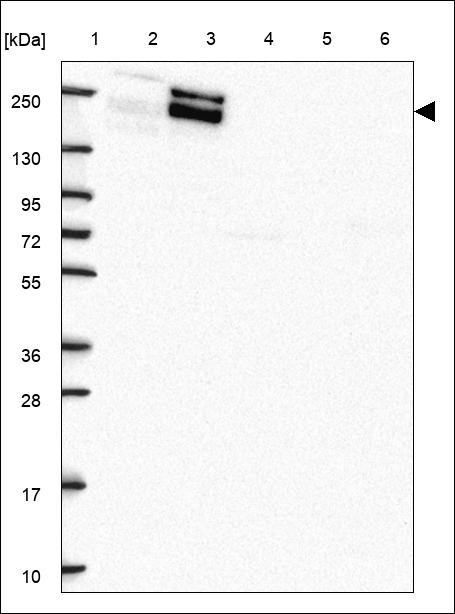 Lane 1: Marker [kDa] 250,130,95,72,55,36,28,17,10 Lane 2: RT4 Lane 3: U-251 MG Lane 4: Human Plasma Lane 5: Liver Lane 6: Tonsil