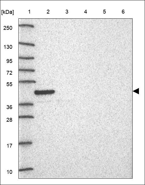 Lane 1: Marker [kDa] 250,130,95,72,55,36,28,17,10 Lane 2: RT4 Lane 3: U-251 MG Lane 4: Human Plasma Lane 5: Liver Lane 6: Tonsil