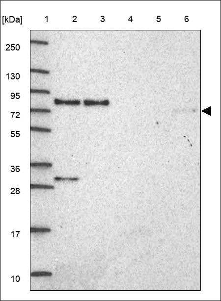 Lane 1: Marker [kDa] 250,130,95,72,55,36,28,17,10 Lane 2: RT4 Lane 3: U-251 MG Lane 4: Human Plasma Lane 5: Liver Lane 6: Tonsil