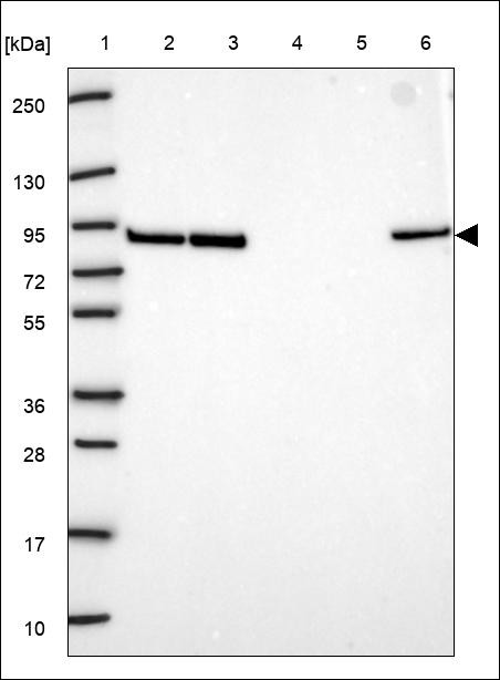 Lane 1: Marker [kDa] 250,130,95,72,55,36,28,17,10 Lane 2: RT4 Lane 3: U-251 MG Lane 4: Human Plasma Lane 5: Liver Lane 6: Tonsil