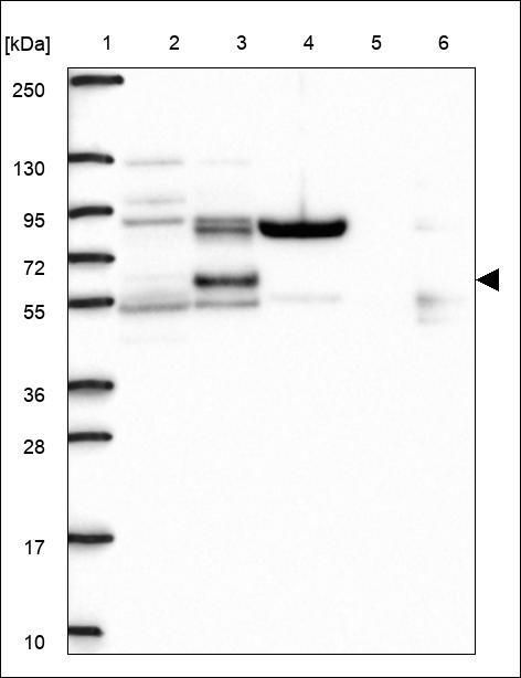 Lane 1: Marker [kDa] 250,130,95,72,55,36,28,17,10 Lane 2: RT4 Lane 3: U-251 MG Lane 4: Human Plasma Lane 5: Liver Lane 6: Tonsil