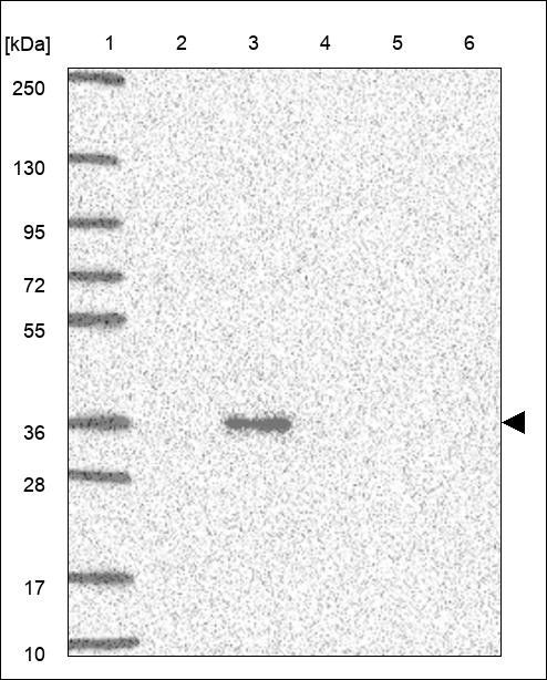 Lane 1: Marker [kDa] 250,130,95,72,55,36,28,17,10 Lane 2: RT4 Lane 3: U-251 MG Lane 4: Human Plasma Lane 5: Liver Lane 6: Tonsil