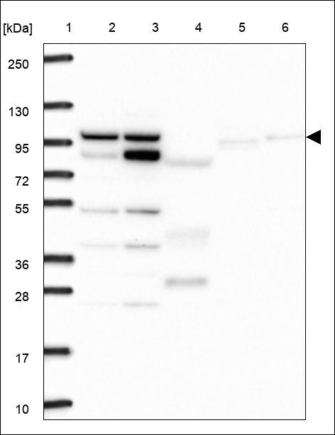 Lane 1: Marker [kDa] 250,130,95,72,55,36,28,17,10 Lane 2: RT4 Lane 3: U-251 MG Lane 4: Human Plasma Lane 5: Liver Lane 6: Tonsil