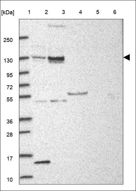 Lane 1: Marker [kDa] 250,130,95,72,55,36,28,17,10 Lane 2: RT4 Lane 3: U-251 MG Lane 4: Human Plasma Lane 5: Liver Lane 6: Tonsil