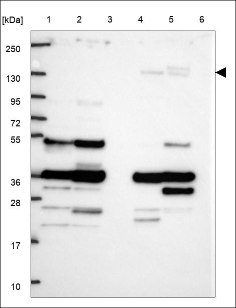Lane 1: Marker [kDa] 250,130,95,72,55,36,28,17,10 Lane 2: RT4 Lane 3: U-251 MG Lane 4: Human Plasma Lane 5: Liver Lane 6: Tonsil