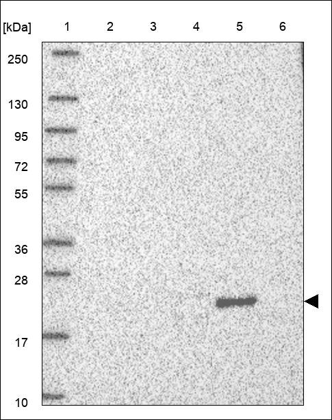 Lane 1: Marker [kDa] 250,130,95,72,55,36,28,17,10 Lane 2: RT4 Lane 3: U-251 MG Lane 4: Human Plasma Lane 5: Liver Lane 6: Tonsil