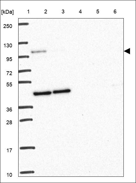 Lane 1: Marker [kDa] 250,130,95,72,55,36,28,17,10 Lane 2: RT4 Lane 3: U-251 MG Lane 4: Human Plasma Lane 5: Liver Lane 6: Tonsil