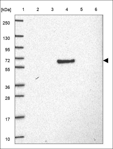 Lane 1: Marker [kDa] 250,130,95,72,55,36,28,17,10 Lane 2: RT4 Lane 3: U-251 MG Lane 4: Human Plasma Lane 5: Liver Lane 6: Tonsil