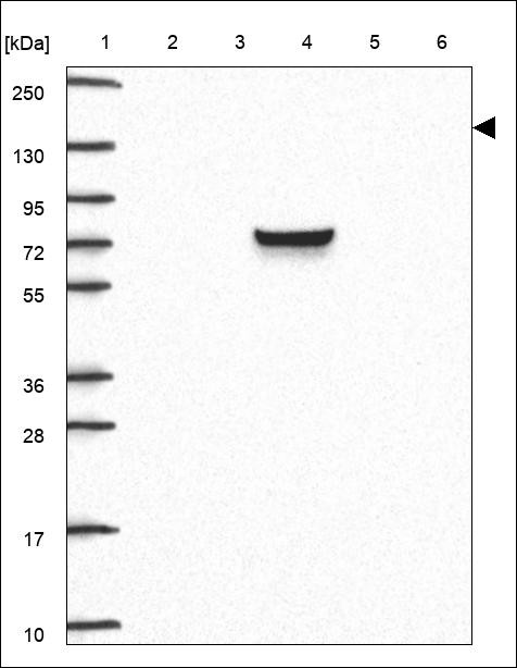 Lane 1: Marker [kDa] 250,130,95,72,55,36,28,17,10 Lane 2: RT4 Lane 3: U-251 MG Lane 4: Human Plasma Lane 5: Liver Lane 6: Tonsil