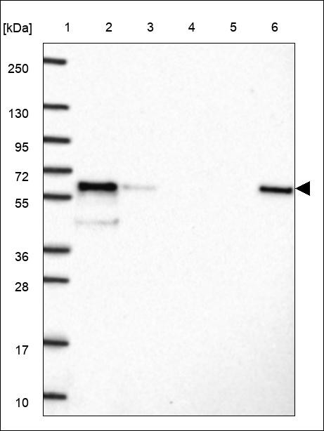 Lane 1: Marker [kDa] 250,130,95,72,55,36,28,17,10 Lane 2: RT4 Lane 3: U-251 MG Lane 4: Human Plasma Lane 5: Liver Lane 6: Tonsil