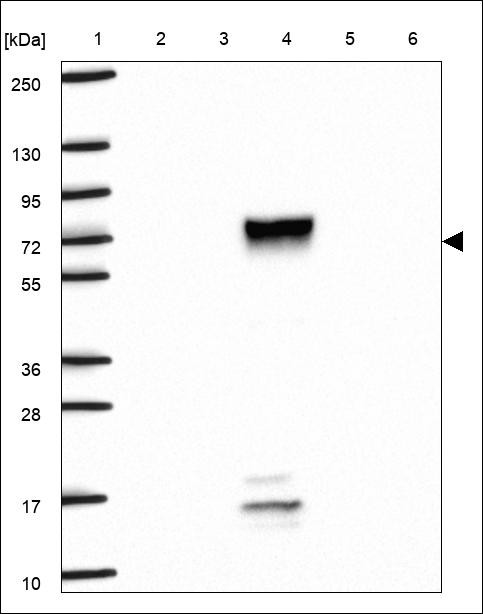 Lane 1: Marker [kDa] 250,130,95,72,55,36,28,17,10 Lane 2: RT4 Lane 3: U-251 MG Lane 4: Human Plasma Lane 5: Liver Lane 6: Tonsil