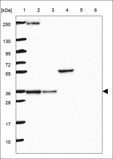 Lane 1: Marker [kDa] 250,130,95,72,55,36,28,17,10 Lane 2: RT4 Lane 3: U-251 MG Lane 4: Human Plasma Lane 5: Liver Lane 6: Tonsil