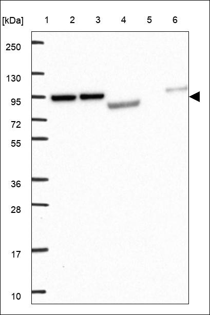 Lane 1: Marker [kDa] 250,130,95,72,55,36,28,17,10 Lane 2: RT4 Lane 3: U-251 MG Lane 4: Human Plasma Lane 5: Liver Lane 6: Tonsil