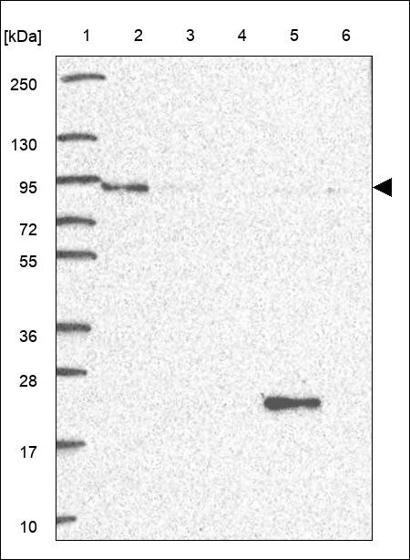 Lane 1: Marker [kDa] 250,130,95,72,55,36,28,17,10 Lane 2: RT4 Lane 3: U-251 MG Lane 4: Human Plasma Lane 5: Liver Lane 6: Tonsil