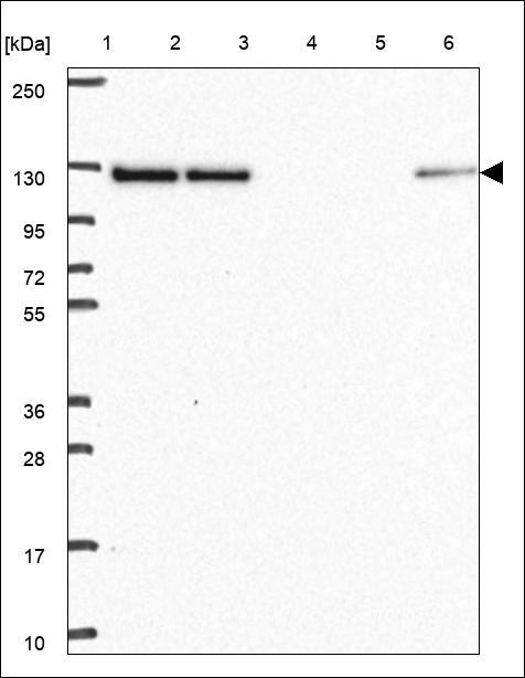 Lane 1: Marker [kDa] 250,130,95,72,55,36,28,17,10 Lane 2: RT4 Lane 3: U-251 MG Lane 4: Human Plasma Lane 5: Liver Lane 6: Tonsil