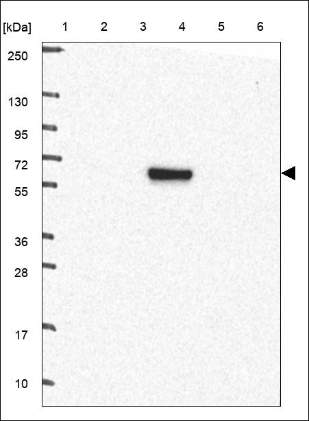 Lane 1: Marker [kDa] 250,130,95,72,55,36,28,17,10 Lane 2: RT4 Lane 3: U-251 MG Lane 4: Human Plasma Lane 5: Liver Lane 6: Tonsil