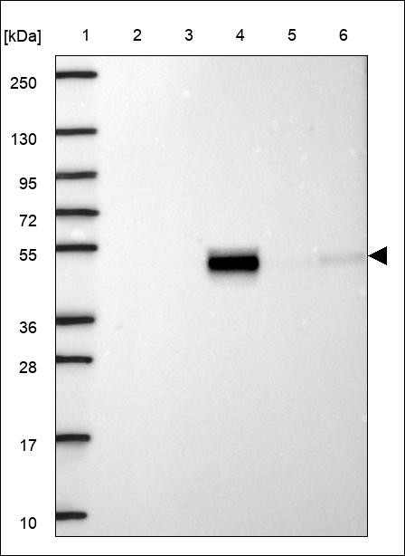 Lane 1: Marker [kDa] 250,130,95,72,55,36,28,17,10 Lane 2: RT4 Lane 3: U-251 MG Lane 4: Human Plasma Lane 5: Liver Lane 6: Tonsil