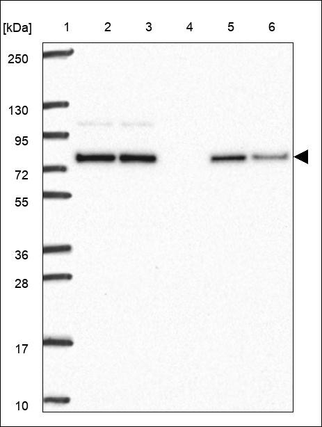 Lane 1: Marker [kDa] 250,130,95,72,55,36,28,17,10 Lane 2: RT4 Lane 3: U-251 MG Lane 4: Human Plasma Lane 5: Liver Lane 6: Tonsil