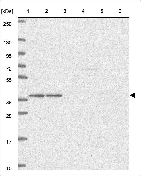 Lane 1: Marker [kDa] 250,130,95,72,55,36,28,17,10 Lane 2: RT4 Lane 3: U-251 MG Lane 4: Human Plasma Lane 5: Liver Lane 6: Tonsil