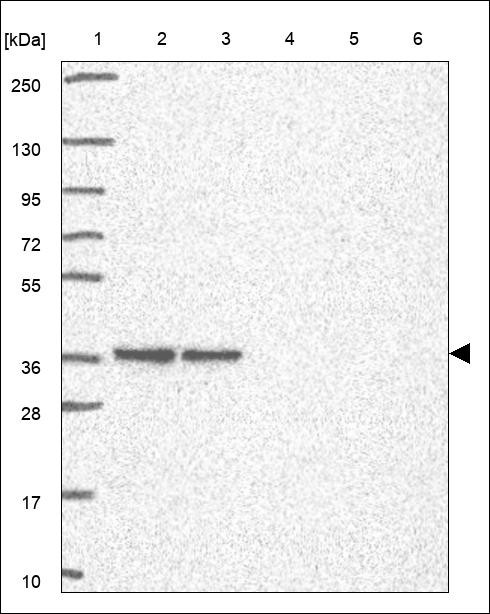 Lane 1: Marker [kDa] 250,130,95,72,55,36,28,17,10 Lane 2: RT4 Lane 3: U-251 MG Lane 4: Human Plasma Lane 5: Liver Lane 6: Tonsil
