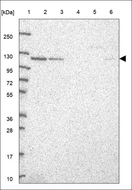 Lane 1: Marker [kDa] 250,130,95,72,55,36,28,17,10 Lane 2: RT4 Lane 3: U-251 MG Lane 4: Human Plasma Lane 5: Liver Lane 6: Tonsil